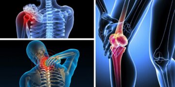Sai lầm trong điều trị bệnh cơ xương khớp khiến bệnh ngày càng trầm trọng hơn