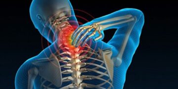 Dinh dưỡng sai lầm gây hại cho hệ xương khớp