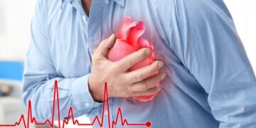 Phòng ngừa nguy cơ tử vong từ bệnh lý nhồi máu cơ tim